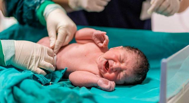 Permisos indisociablemente unidos al tiempo de trabajo. Médico cortando cordón umbilical de un bebé