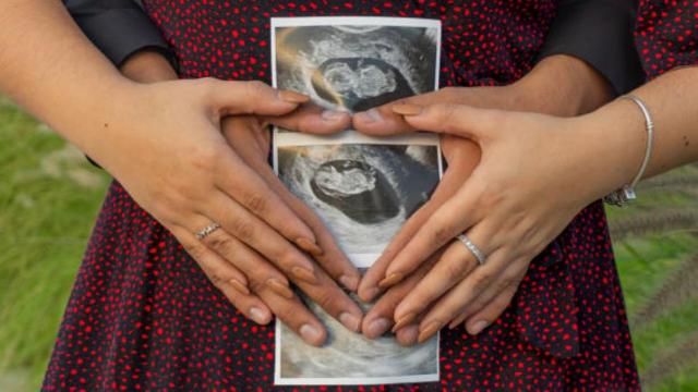 Embarazo múltiple con partos diferidos Embarazo múltiple con partos diferidos